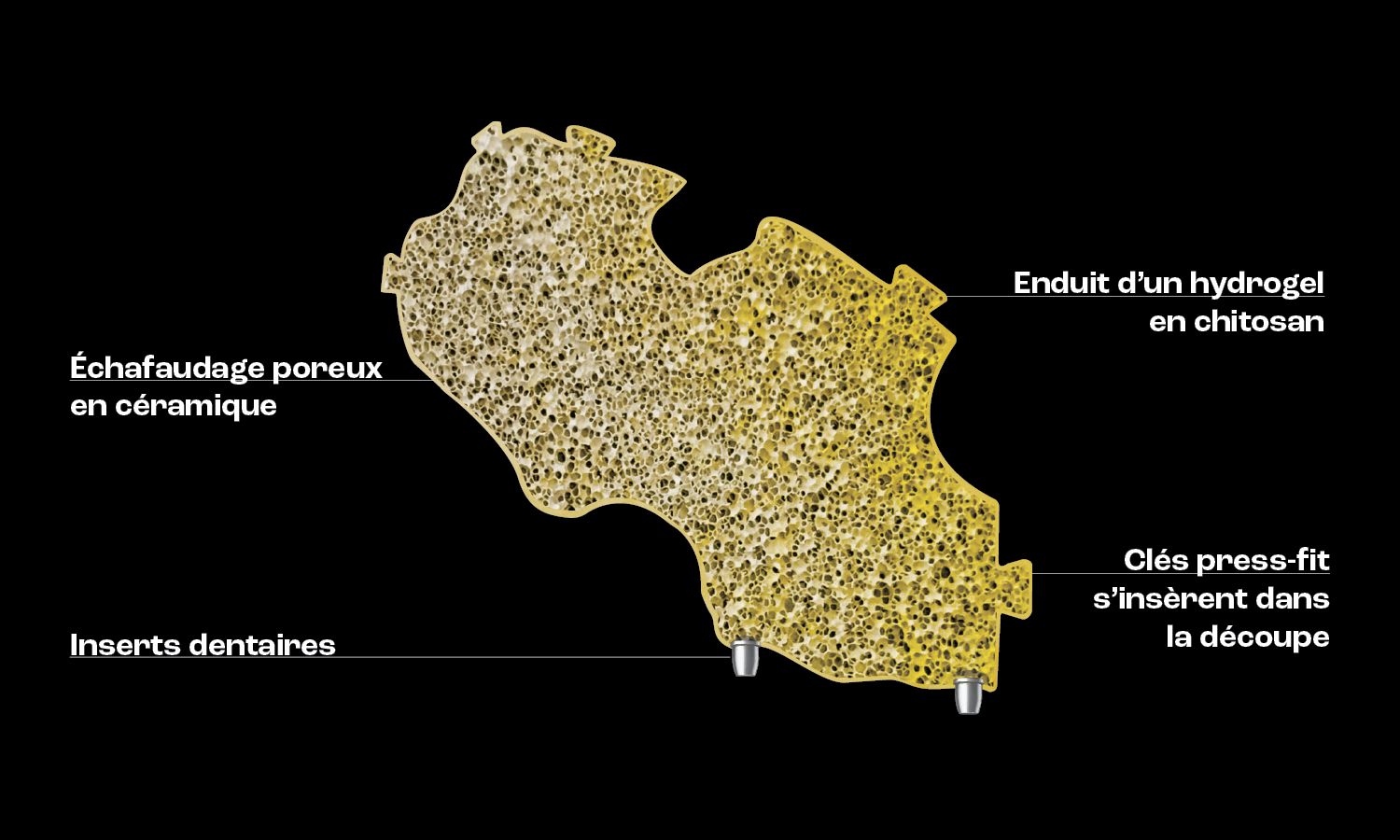 L'implant : &Eacute;chafaudage poreux &agrave; travers lequel l'os peut se remodeler