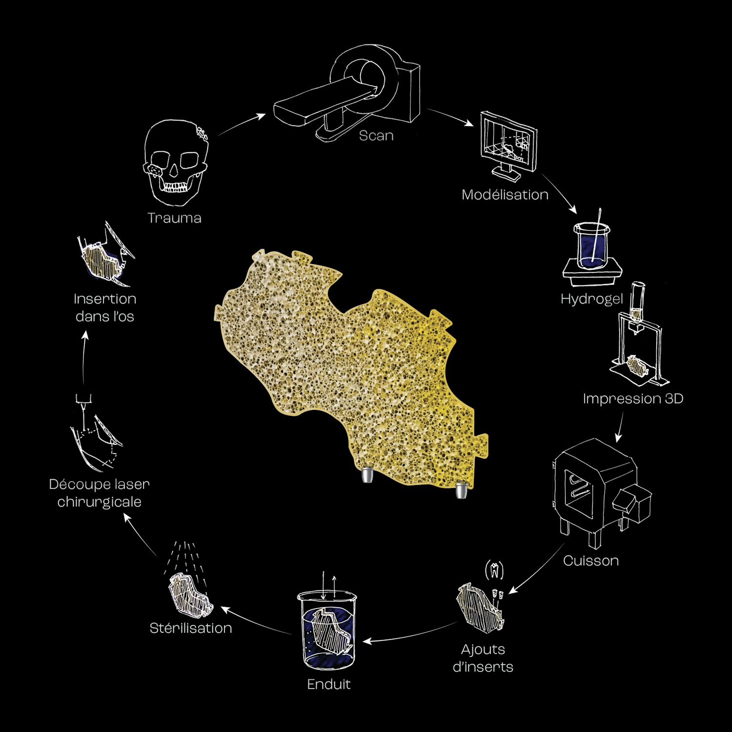 Sc&eacute;nario d'utilisation et de production de l'implant