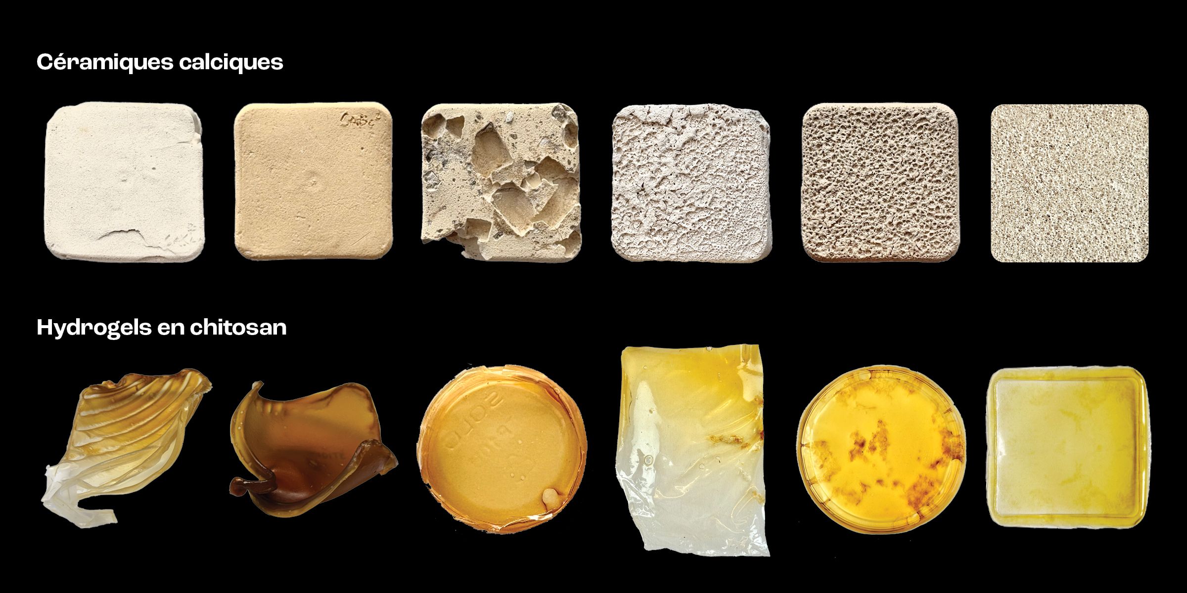 D&eacute;veloppement des mat&eacute;riaux d'implants et de bandages